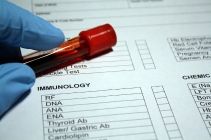 Recent research ideas on Immunology 2023 blog image