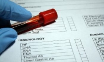 Recent research ideas on Immunology 2023 blog image