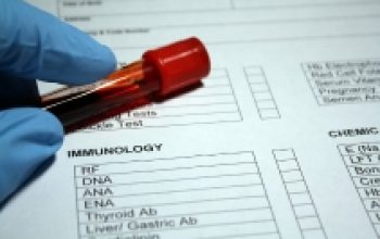 Recent research ideas on Immunology 2023 blog image